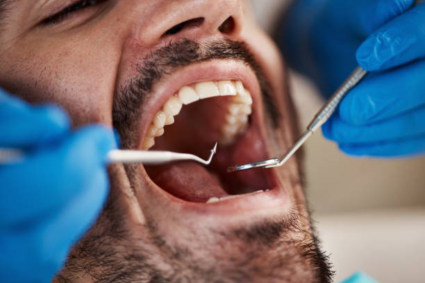 Best Emergency Dentist for Special Needs Patients in Campti, LA